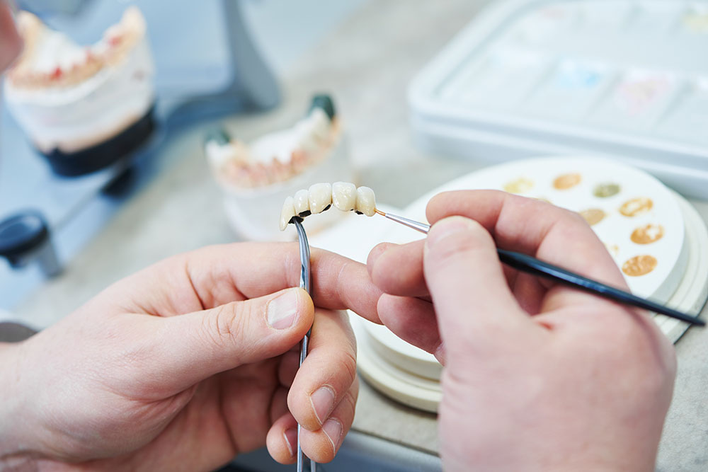 Zahntechniker beim Bemalen von Zähnen während der Arbeit an Zahnprothesen